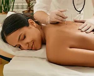 Acupuncture for arthritis