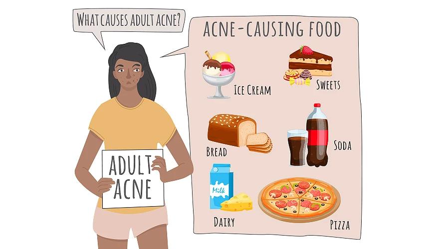 What is adult acne