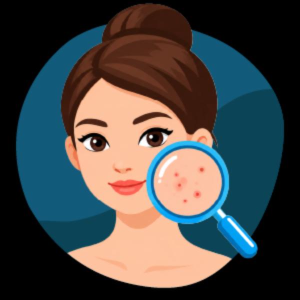 Acne Quiz