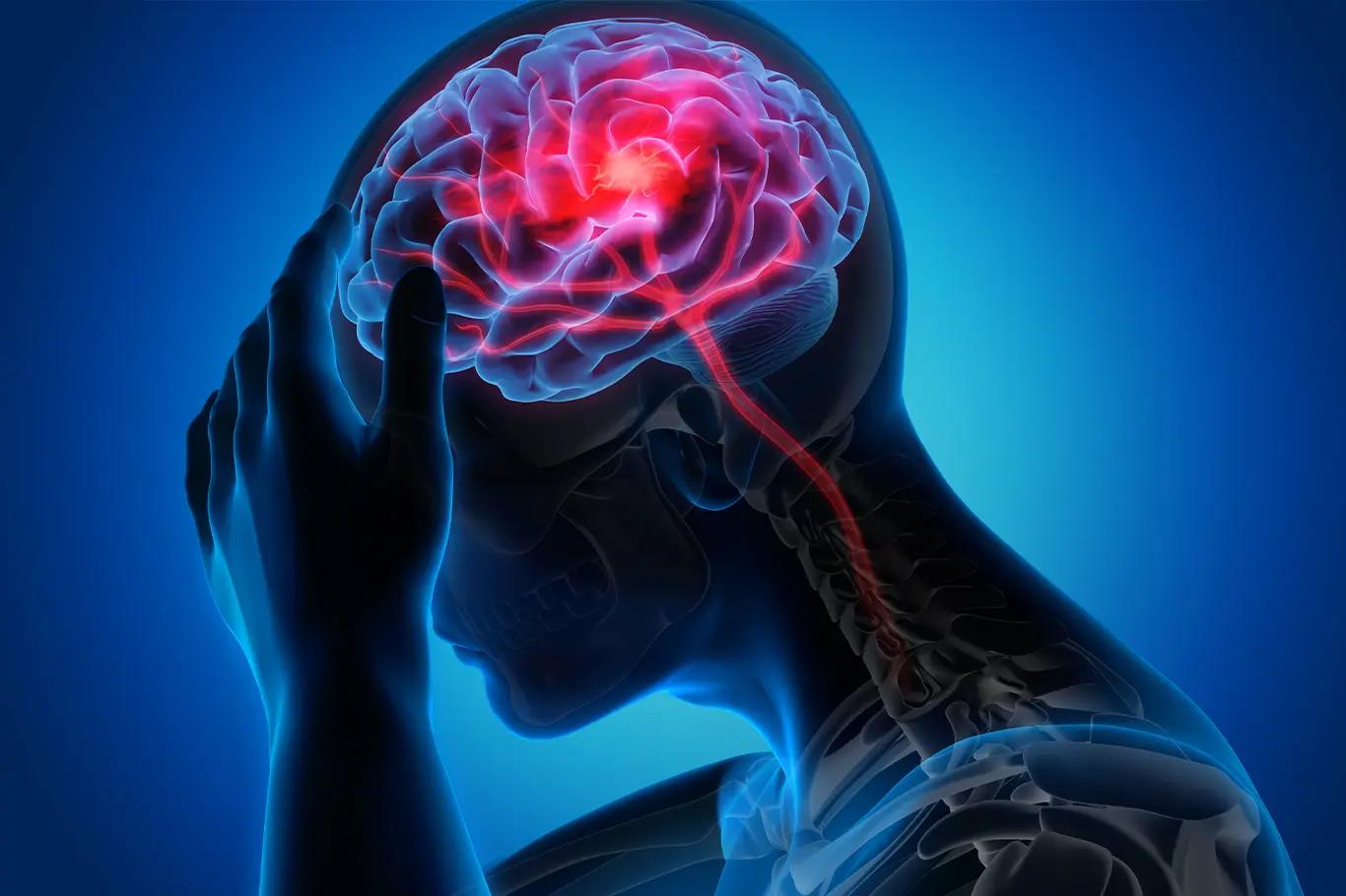 How to spot a stroke: signs and symptoms