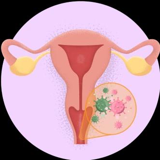 Counters Vaginal Infections1