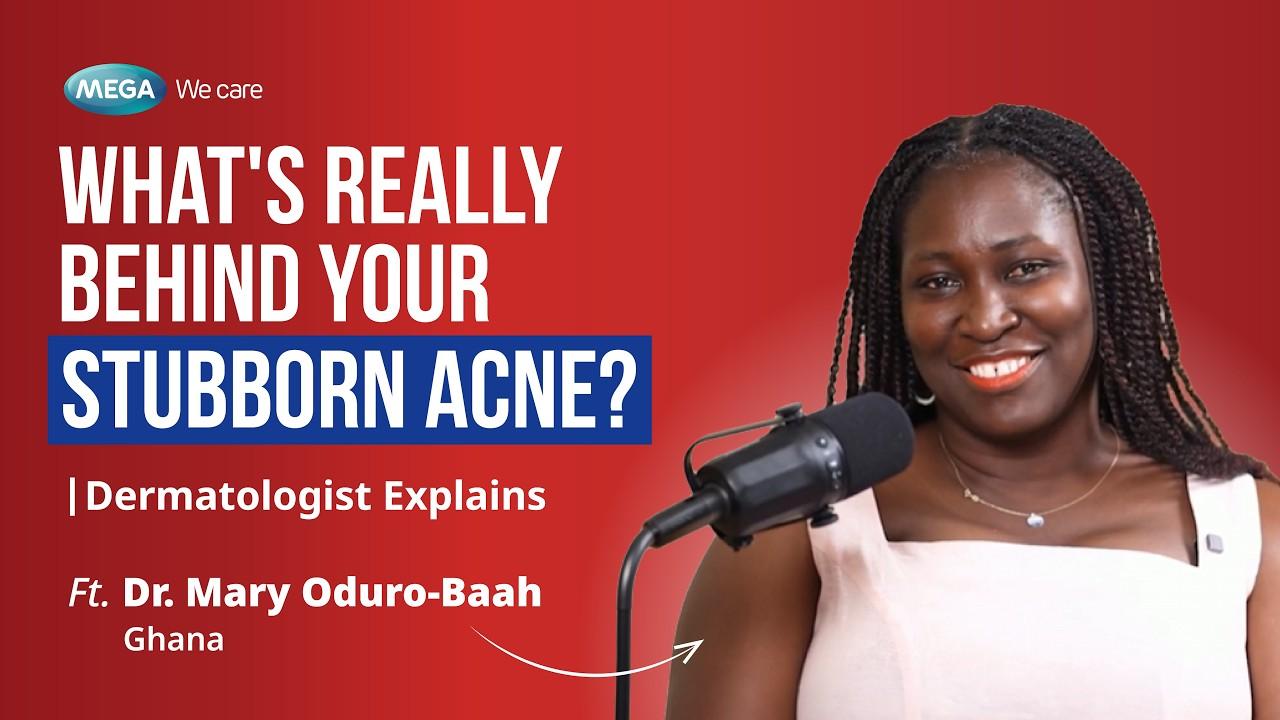 What’s Really Behind Your Stubborn Acne
