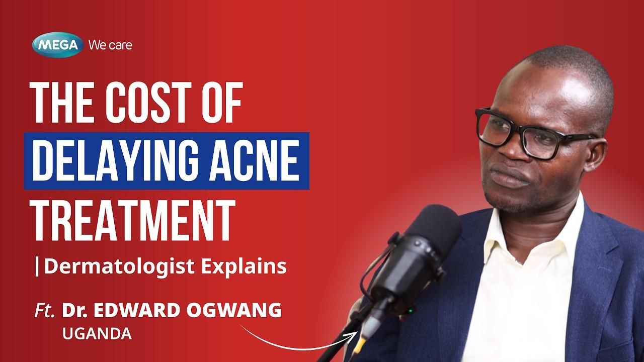 The Cost of Delaying Acne Treatment