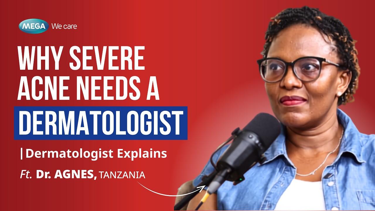Why Severe Acne Needs a Dermatologist