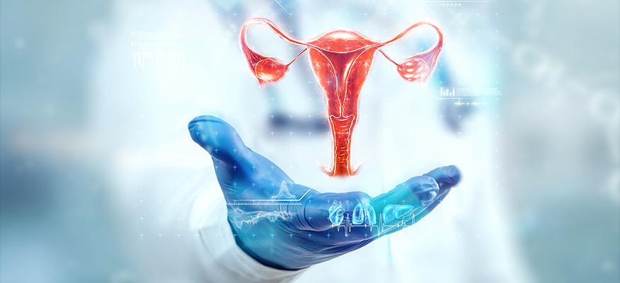 Illustration depicting the concept of ectopic pregnancy, showing fertilized egg implantation outside the uterus.