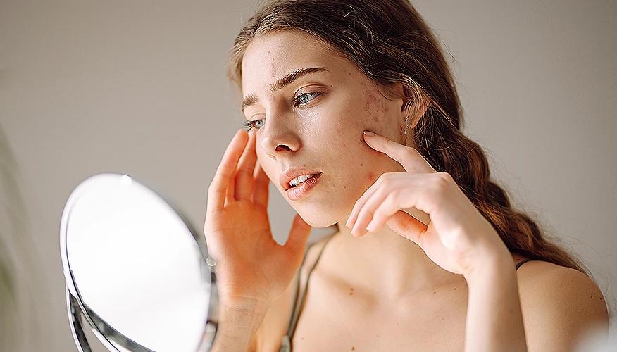 Skincare for adult acne