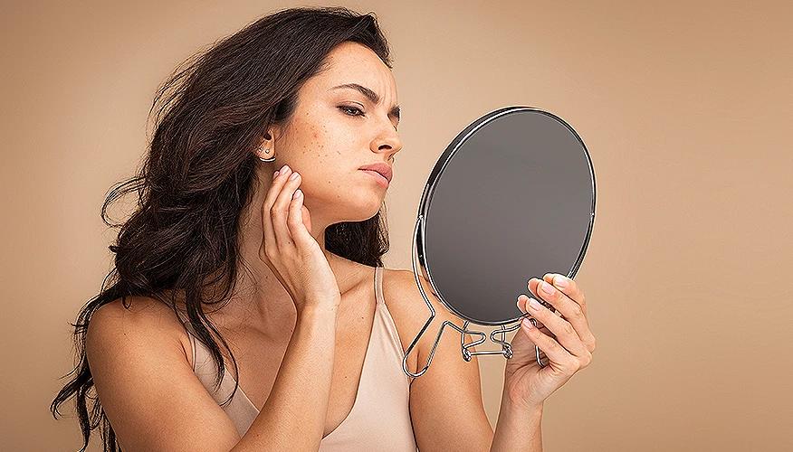 Understanding why acne sometimes needs professional care