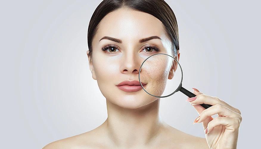 Can acne scars be treated
