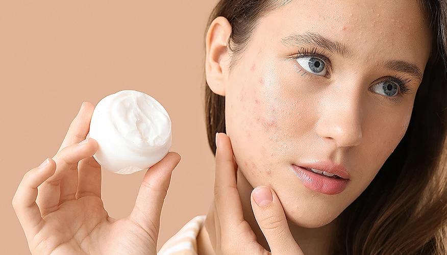Skincare routines that help with cheek acne