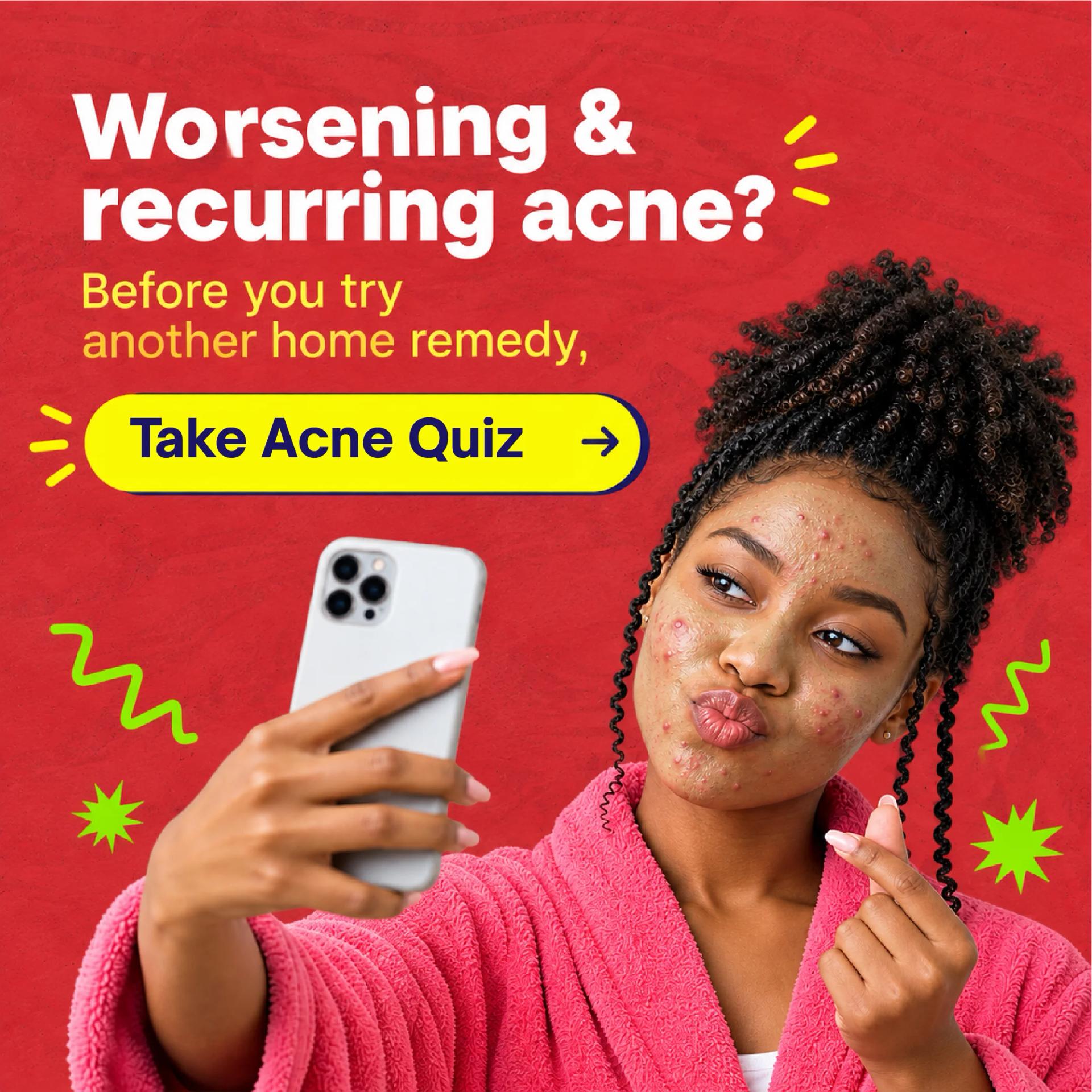 Acne Quiz