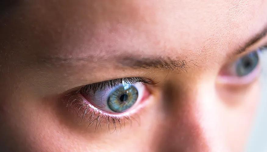 Common thyroid eye disease symptoms