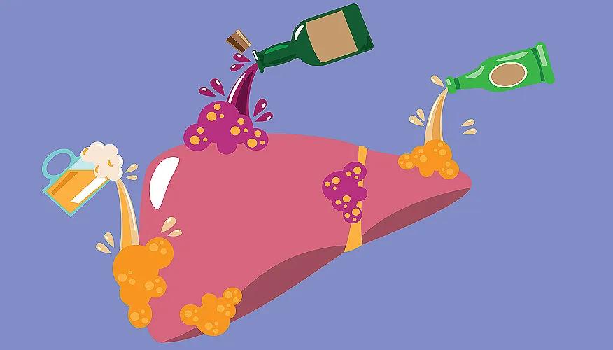 Fatty liver disease risk factors