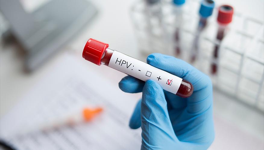 Having HPV