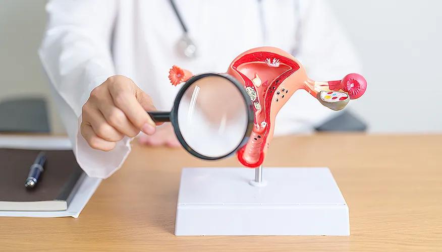 Understanding fibroids