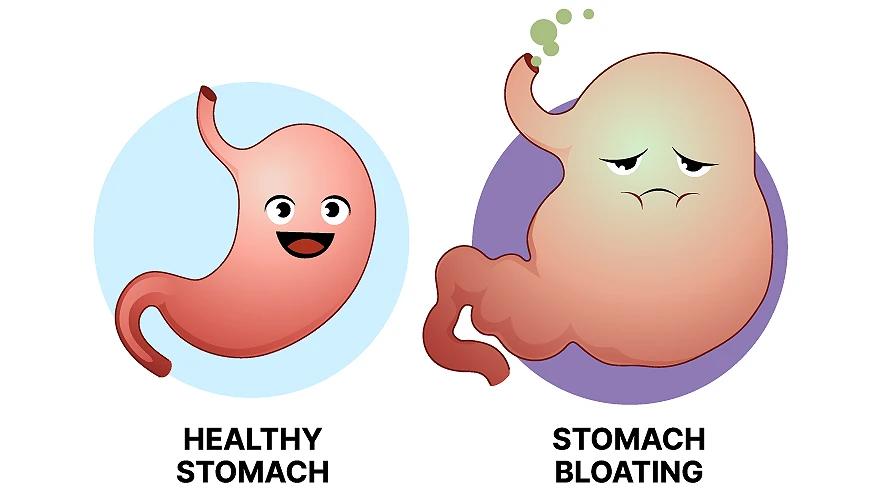 What are probiotics