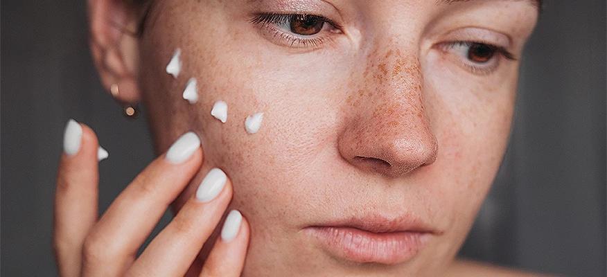 Dangers of Steroid Creams: Acne Risks and Self-Medication