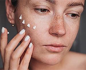 Dangers of Steroid Creams: Acne Risks and Self-Medication