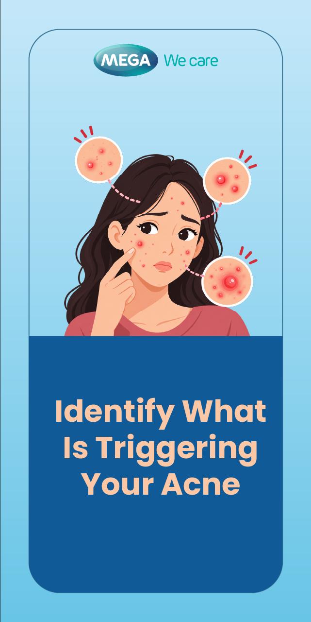 Identify What is Triggering Your Acne?