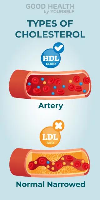 Types of Cholesterol