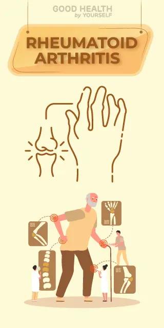 Rheumatoid Arthritis
