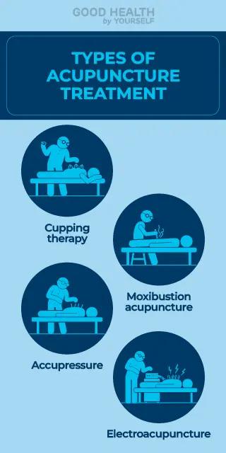 Acupuncture in arthritis pain